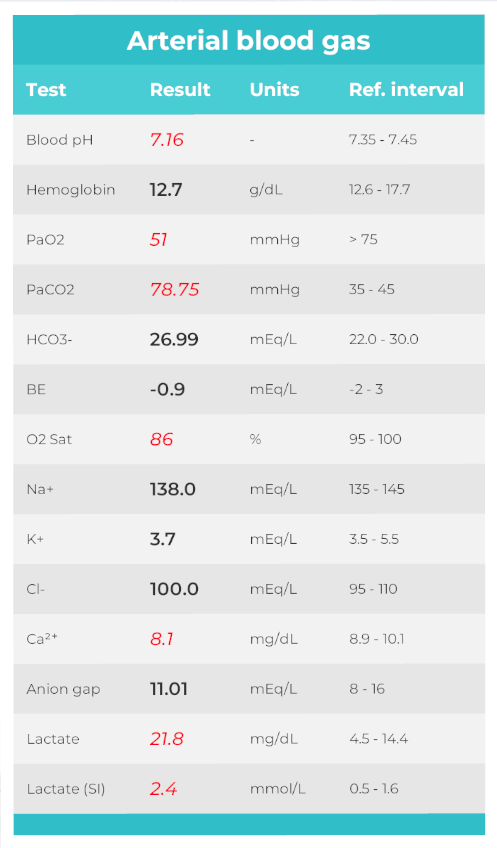 advanced ventilator algorithm internal 2